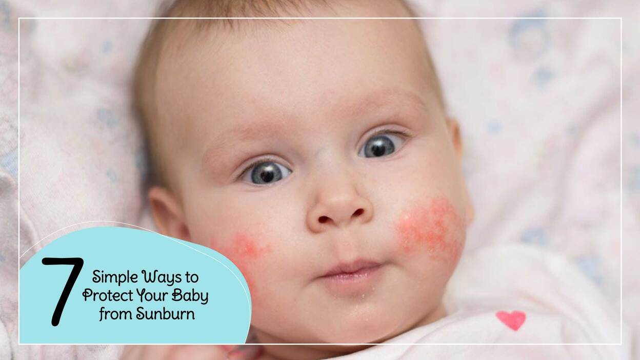7 Simple Ways to Protect Your Baby from Sunburn